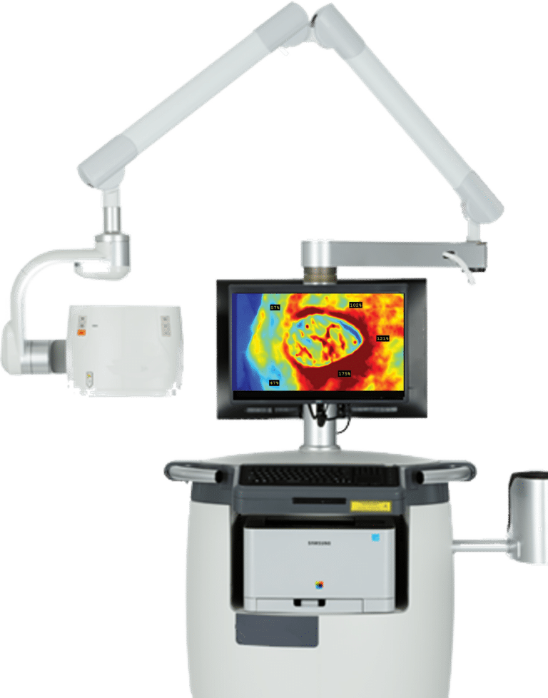 perfusionspyscreen_imaging system