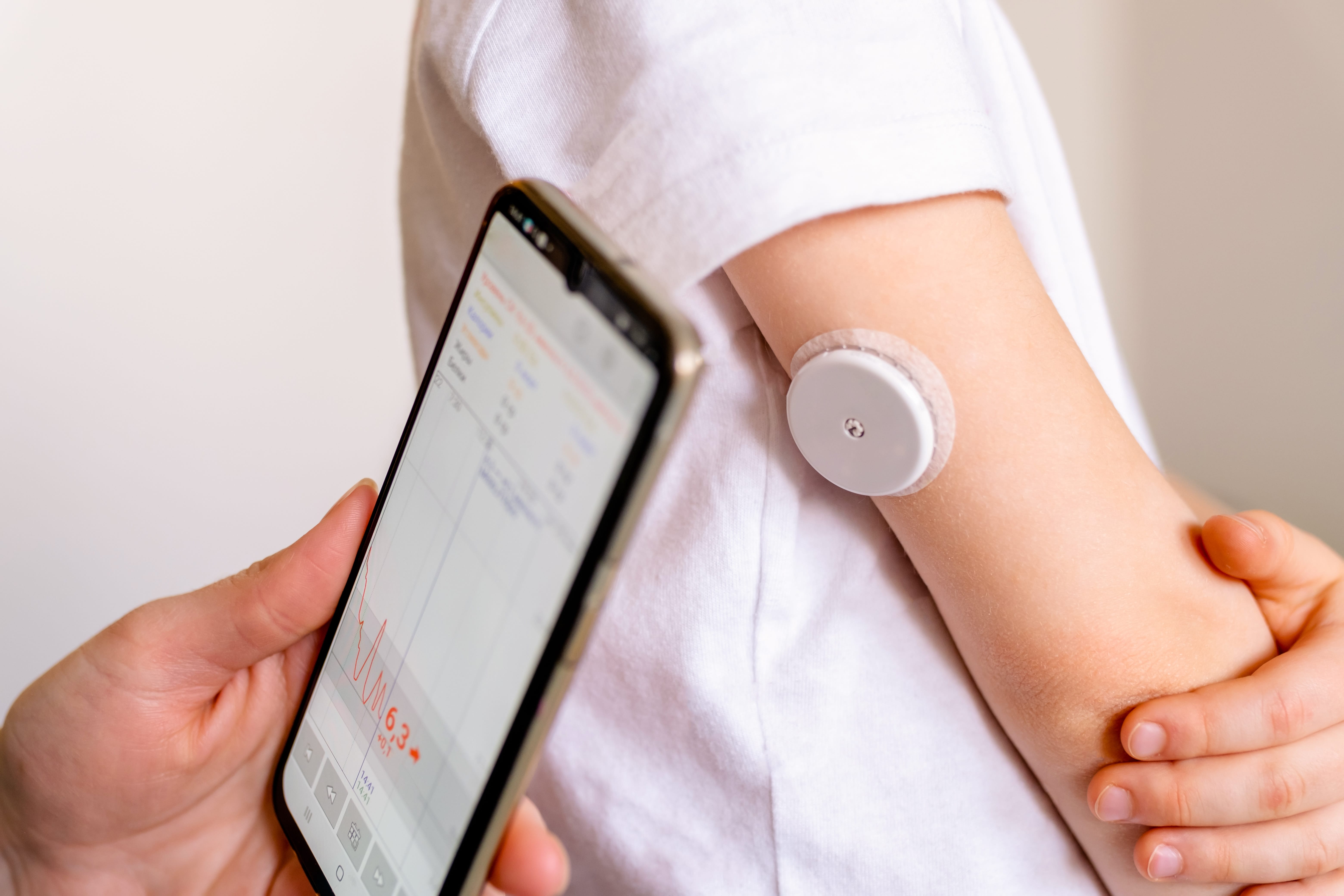 Connected Diabetes Medical Device Monitor